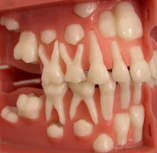 Молочные зубы у детей выпадение в каком возрасте схема