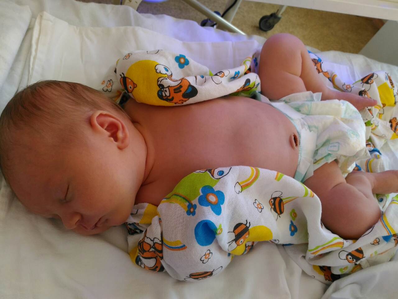 1 5 месяца после родов. Желтушка у новорожденных. Желтуха у новорождённых. Что такое желтушка у новорожденных детей. Дети с желтухой Новорожденные.