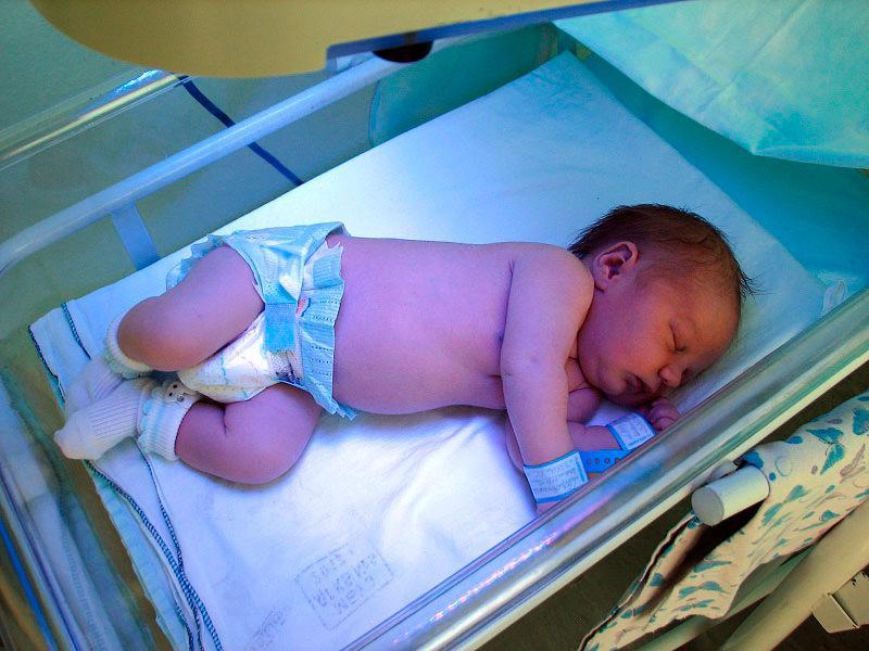 Лечение желтушки у новорожденных с помощью лампы