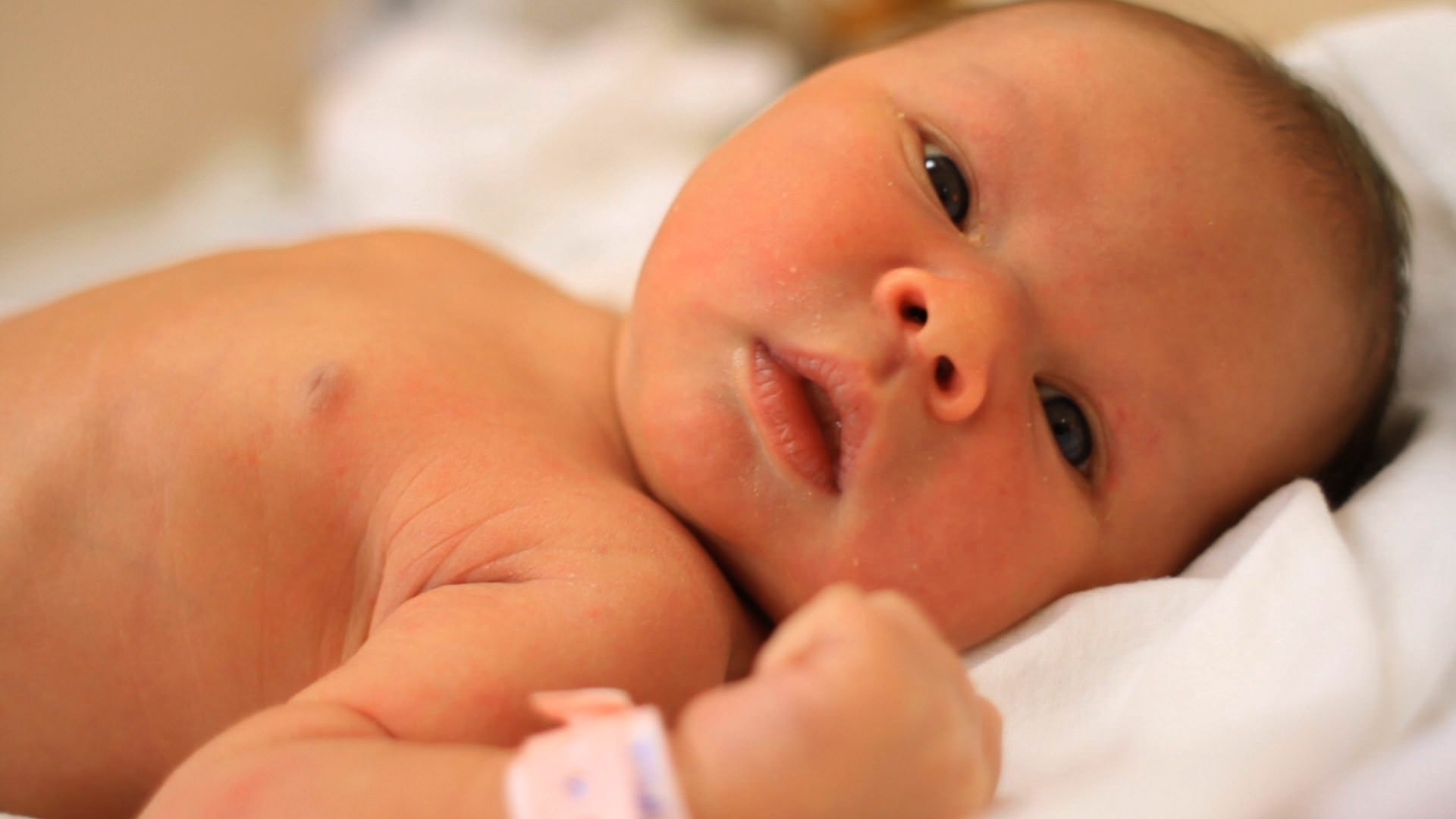 Первые месяцы после рождения. Желтушка у новорожденных фото. Кожа новорожденного с желтушкой. Цвет кожи новорожденного ребенка. Новорождённый ребёнок с желтушкой.