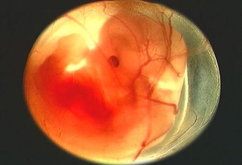 развитие эмбриона на 9 неделе беременности 